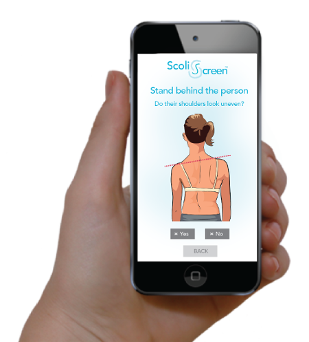 Online screening for the signs of scoliosis
